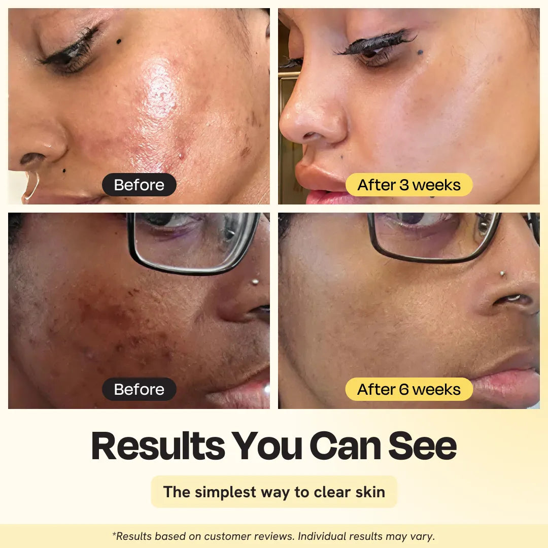 Héros des taches sombres