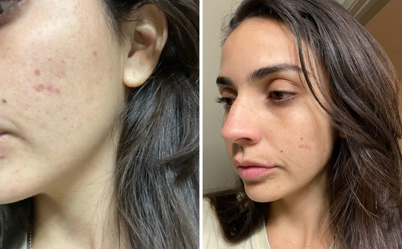 Before and after photos shared by Mara M.