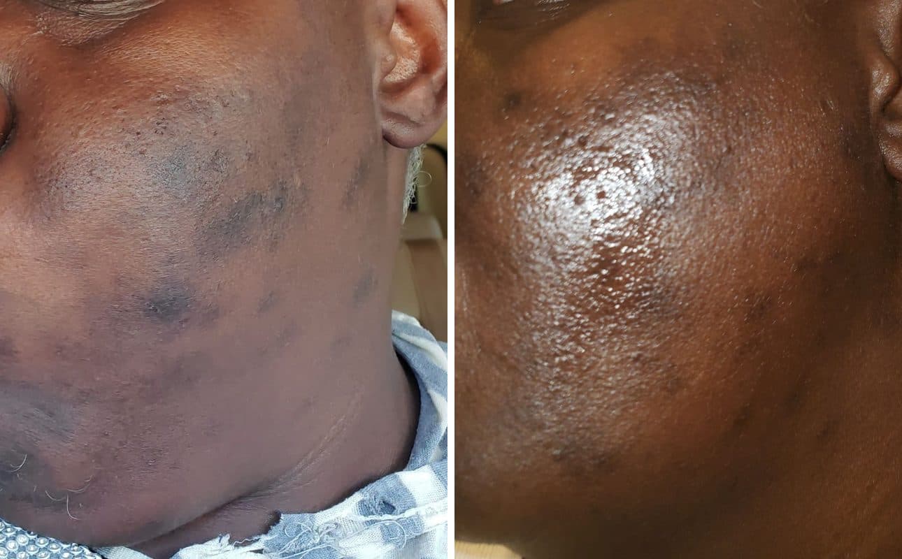 Before and after photos shared by Elonda S.
