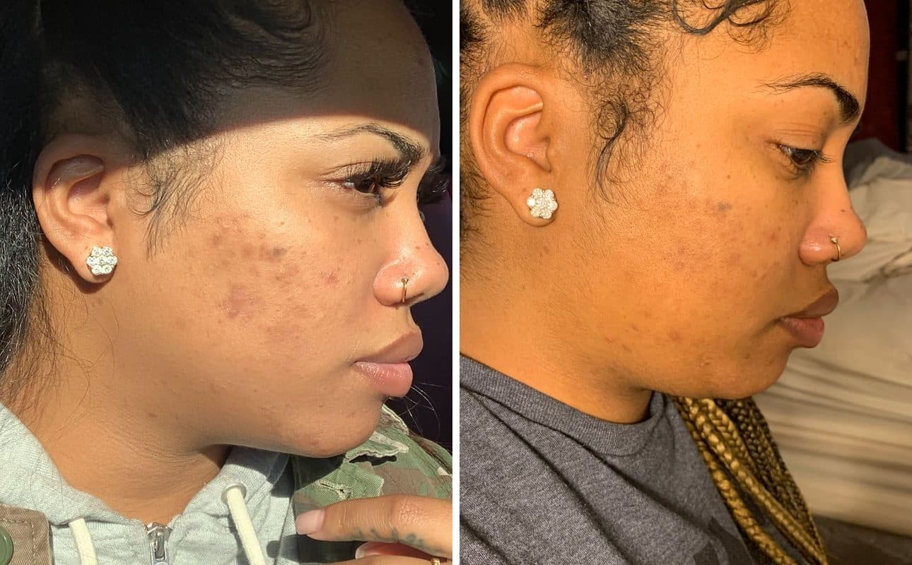 Before and after photos shared by Ashley W.