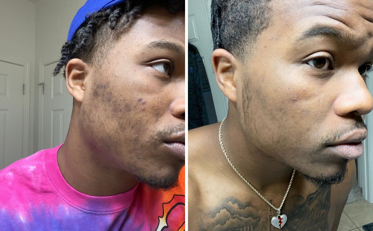 Before and after photos shared by Jaylin J.