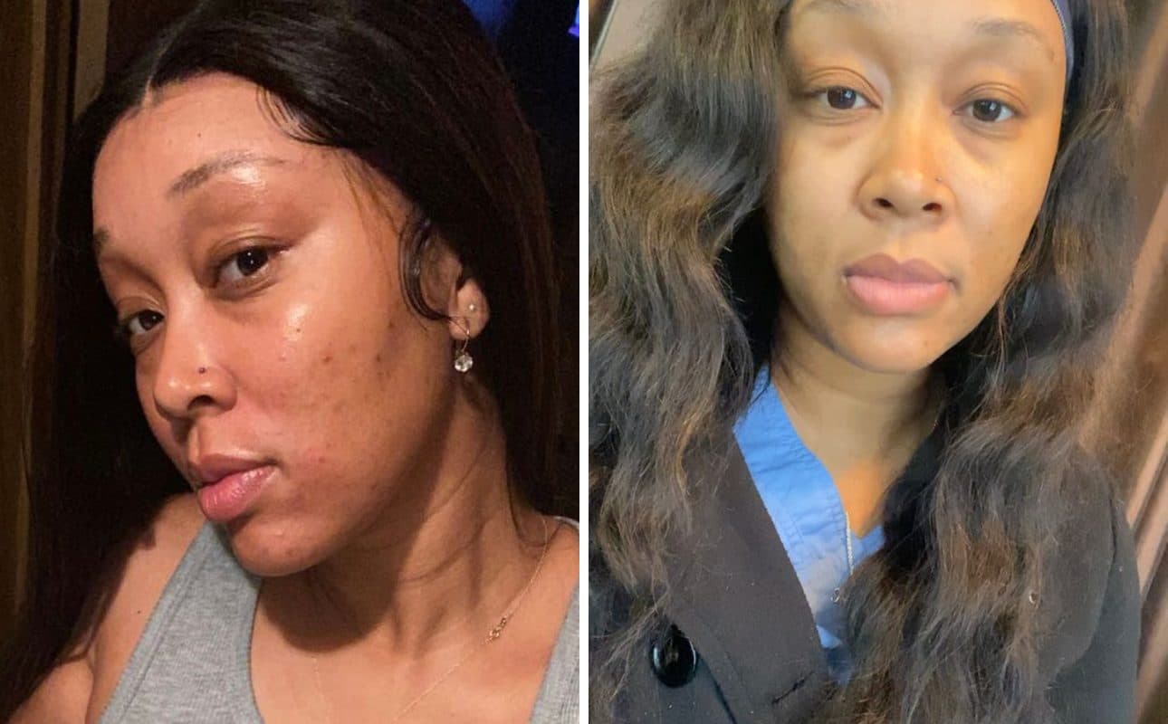 Before and after photos shared by Lakisha F.