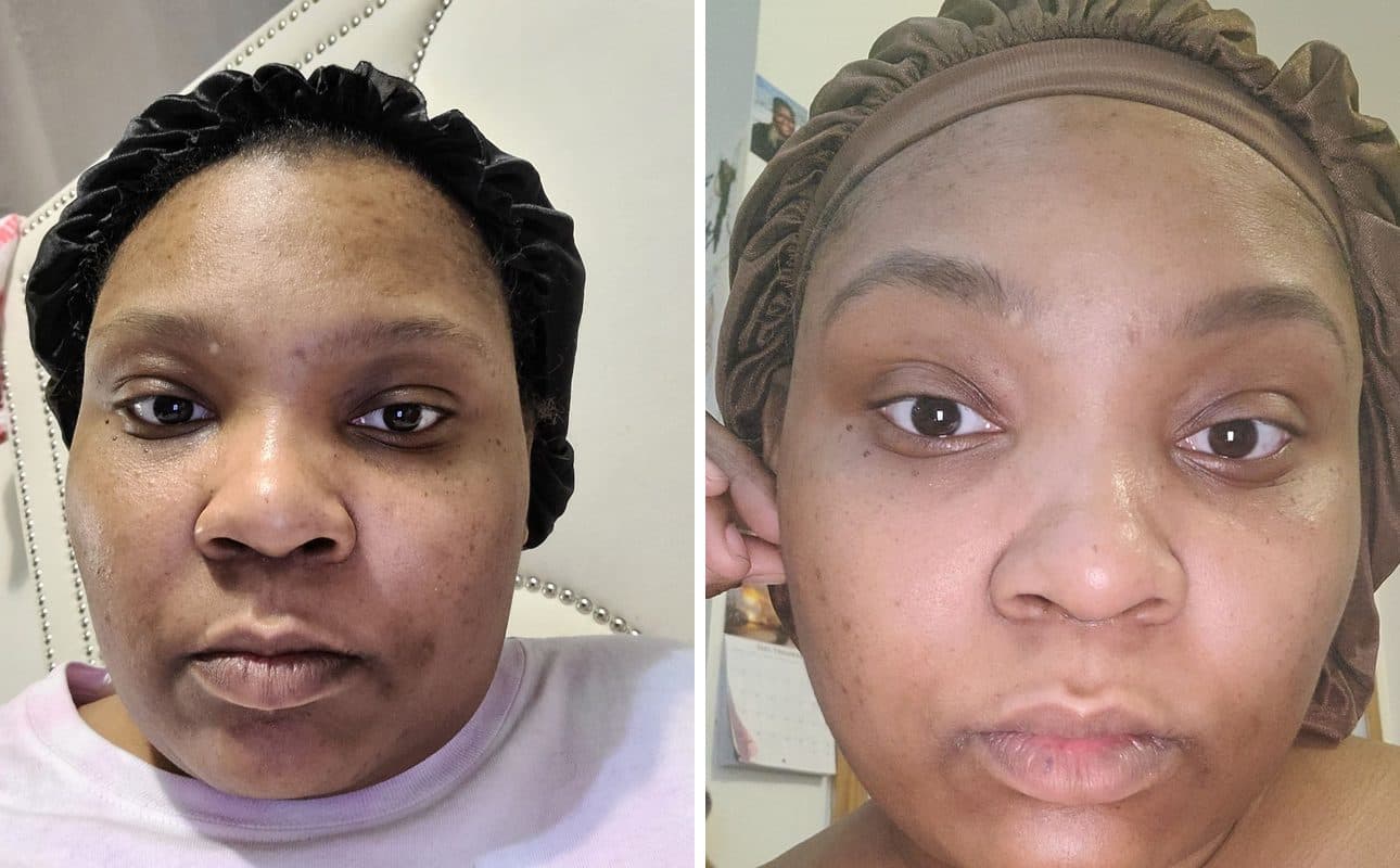 Before and after photos shared by Pearl S.