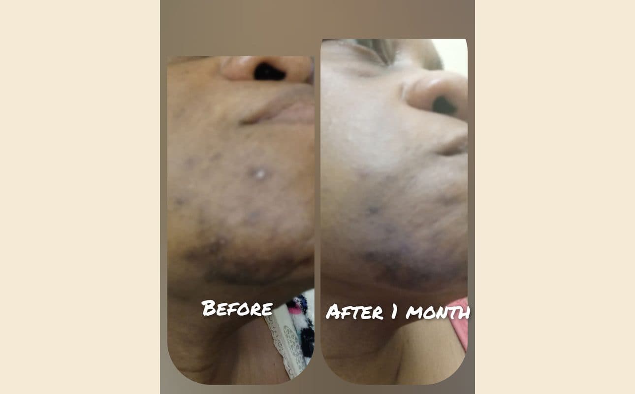 Before-and-after collage shared by April M.