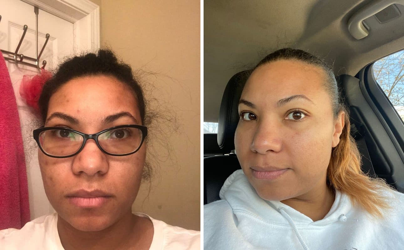 Before and after photos shared by Sharee W.