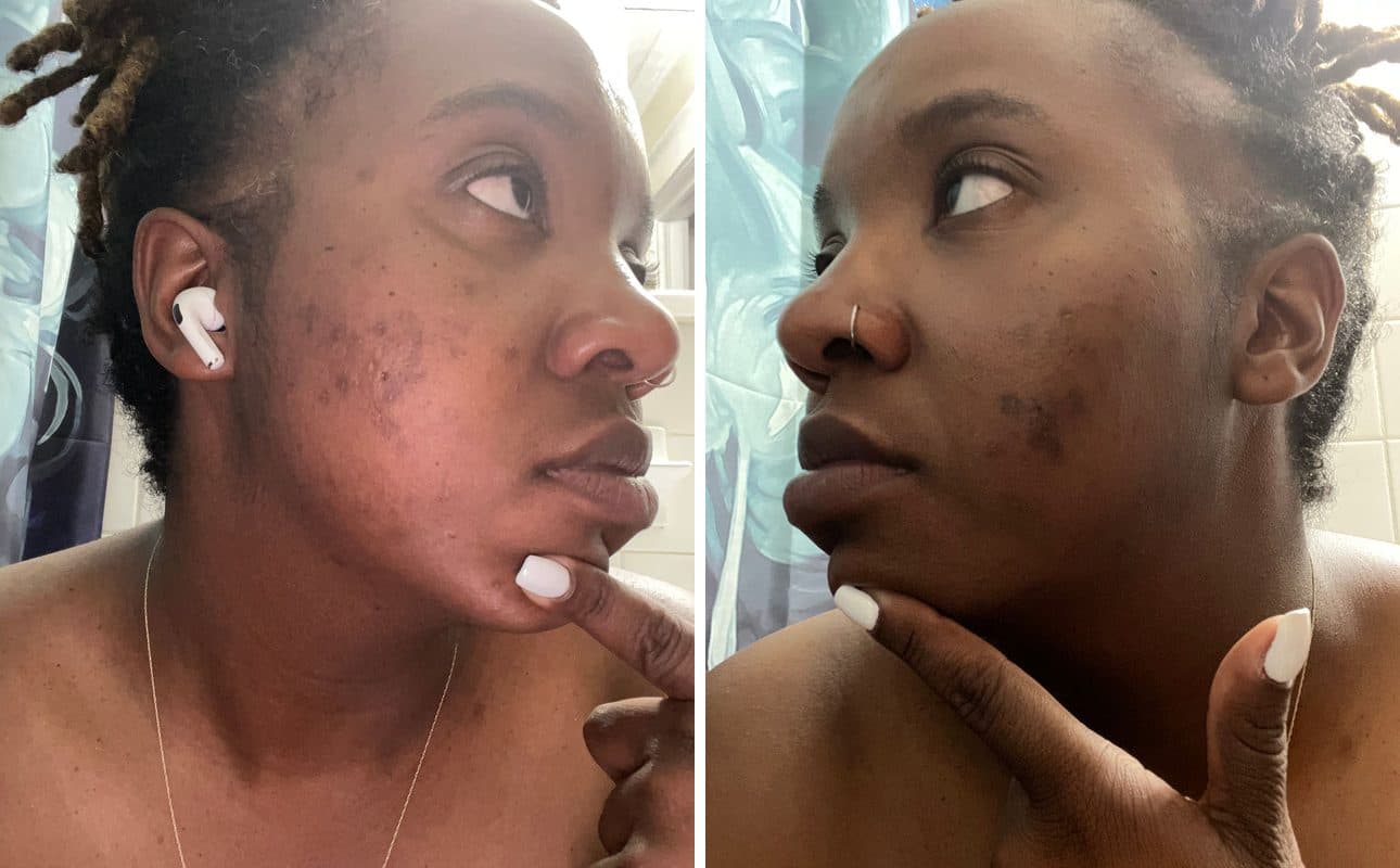 Before and after photos shared by Natosha B.