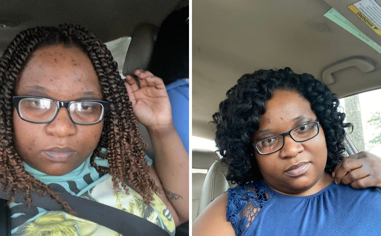 Before and after photos shared by Cherita R.