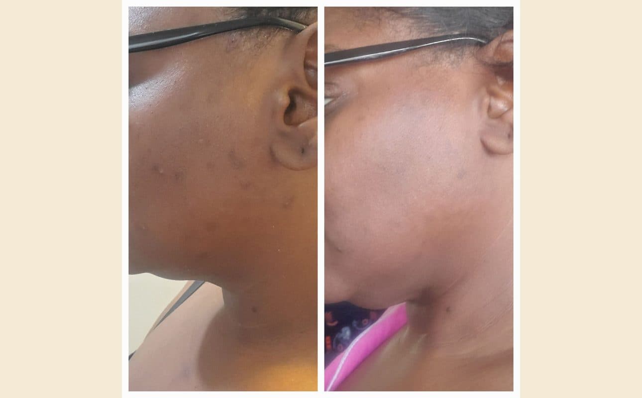 Before-and-after collage shared by Monica B.