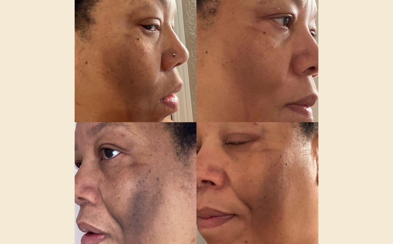 Before-and-after collage shared by Helena B.