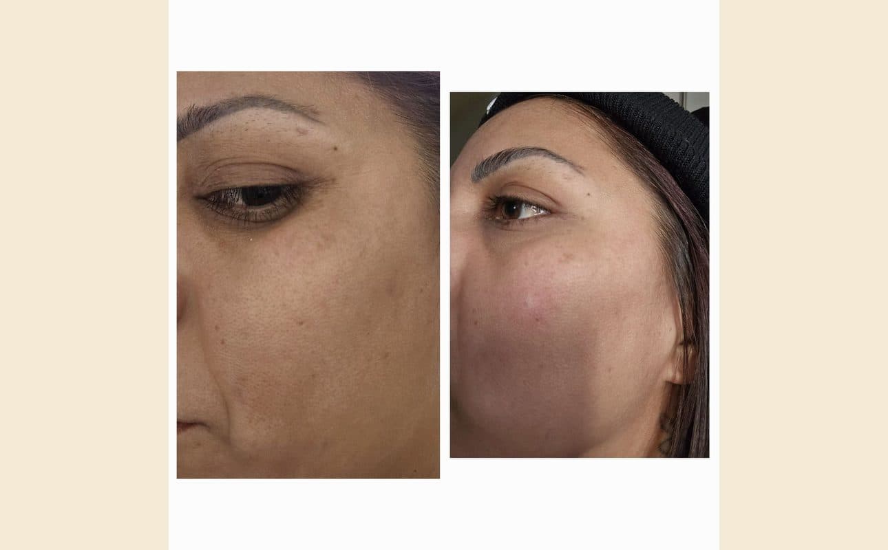 Before-and-after collage shared by Clara V.