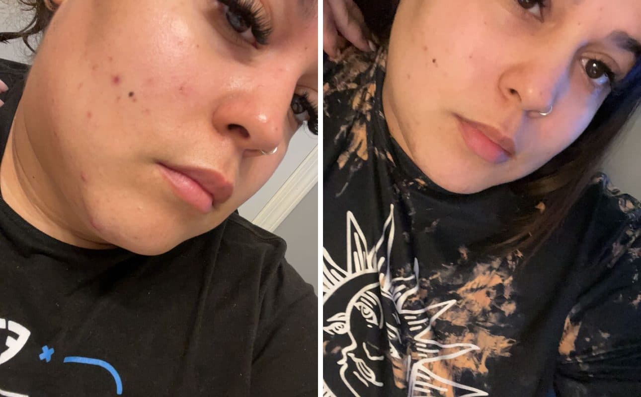 Before and after photos shared by Amanda G.