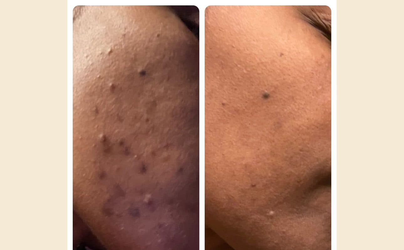 Before-and-after collage shared by Tori S.