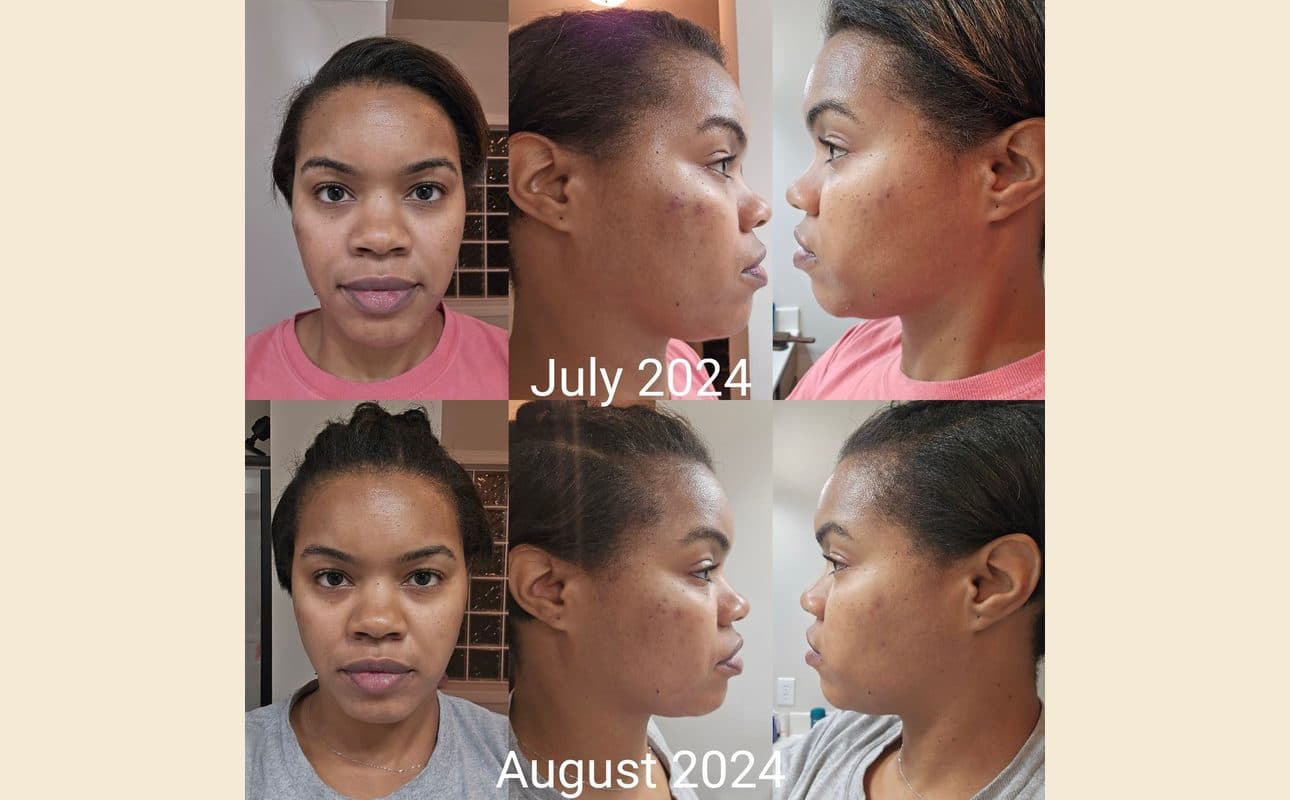 Before-and-after collage shared by Oriana B.