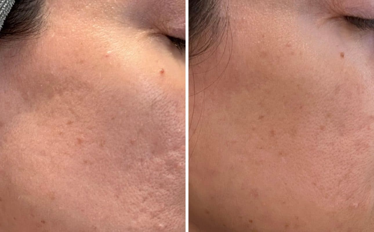 Before and after photos shared by Lisa A.