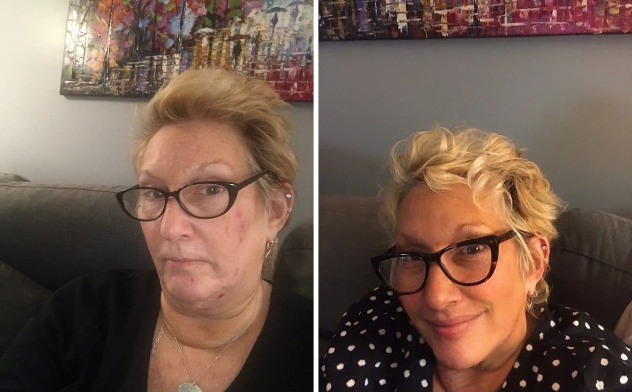 Before and after photos shared by Amy C.