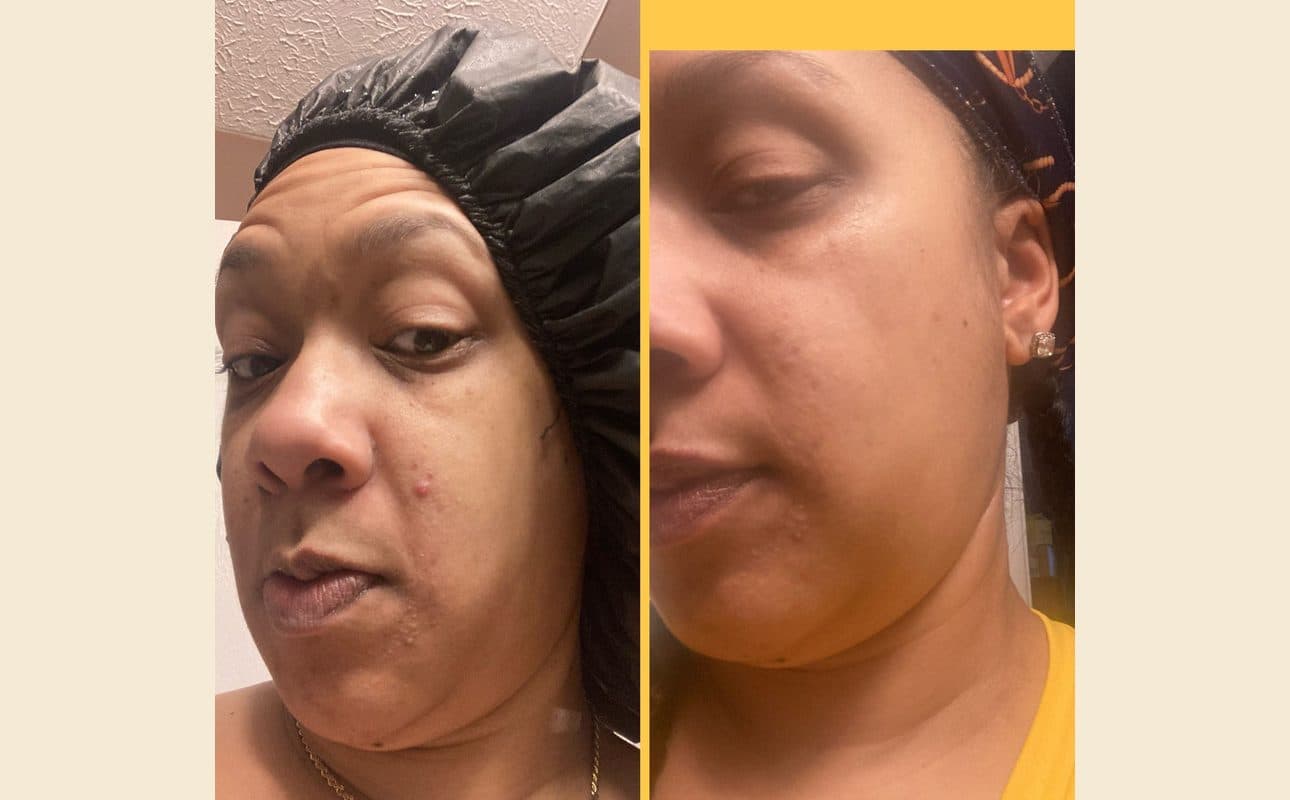 Before-and-after collage shared by Lauren J.
