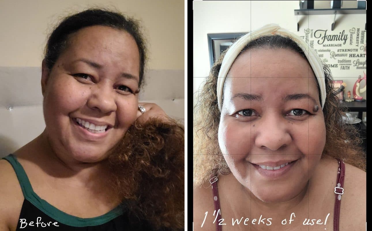 Before and after photos shared by Jacqueline W.