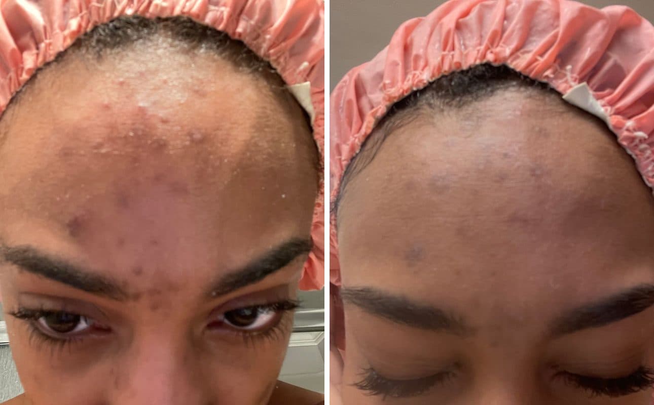Before and after photos shared by Cayla C.