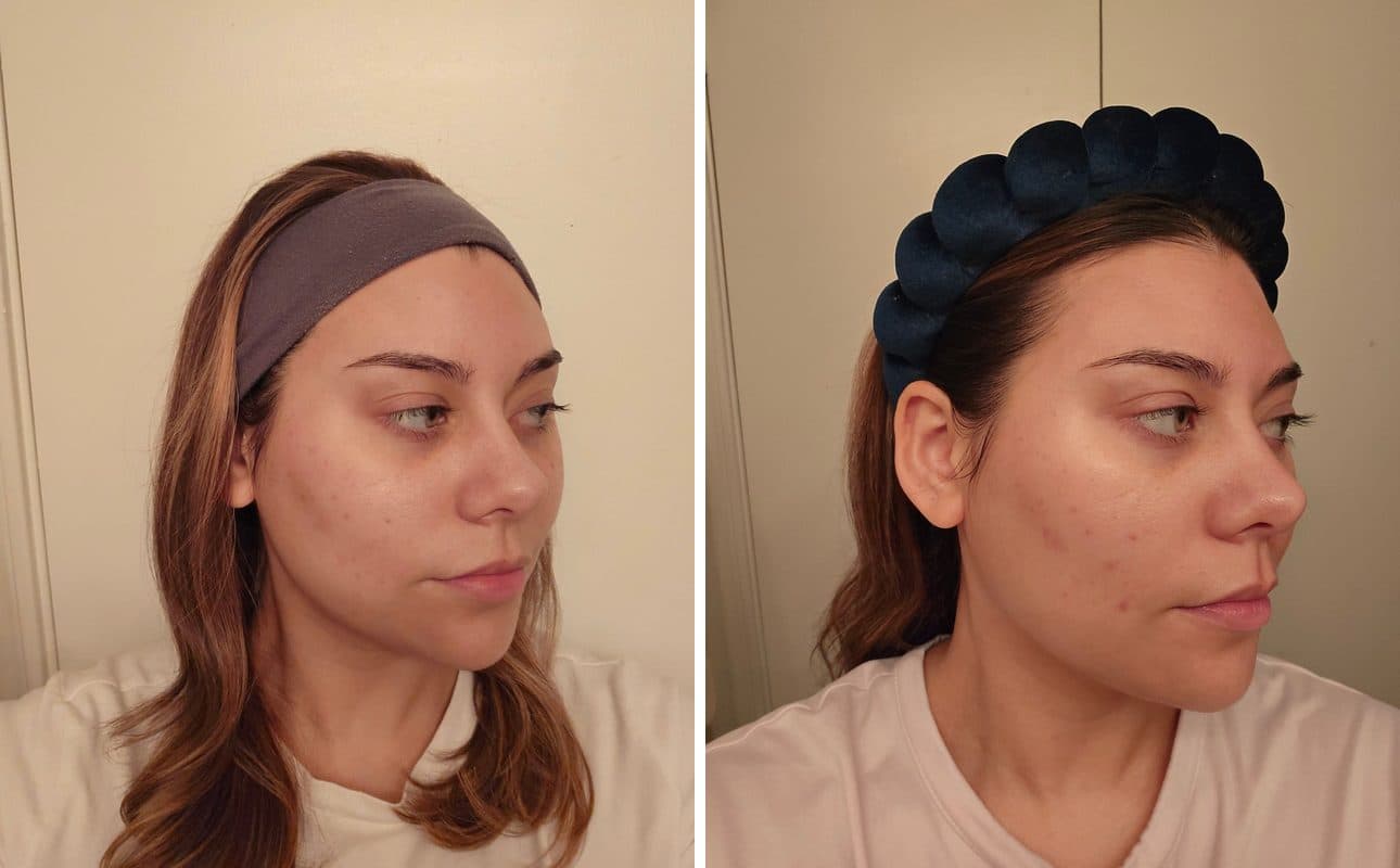 Before and after photos shared by Erin W.