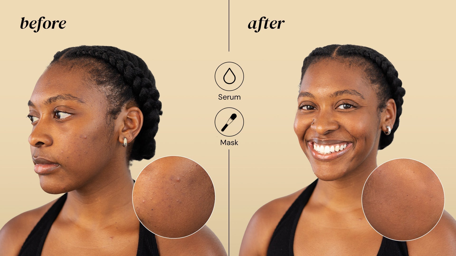 How Vitamin C Helps Combat Dark Spots and Hyperpigmentation