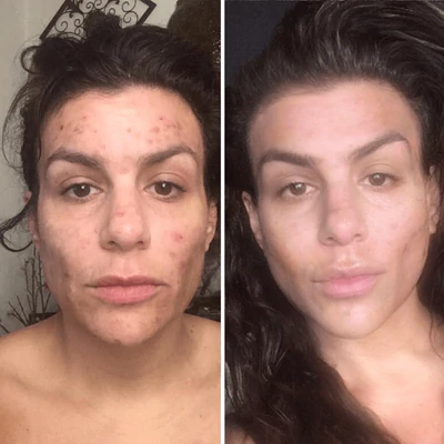 before and after image from using Gleaming Clay Mask for Nina S