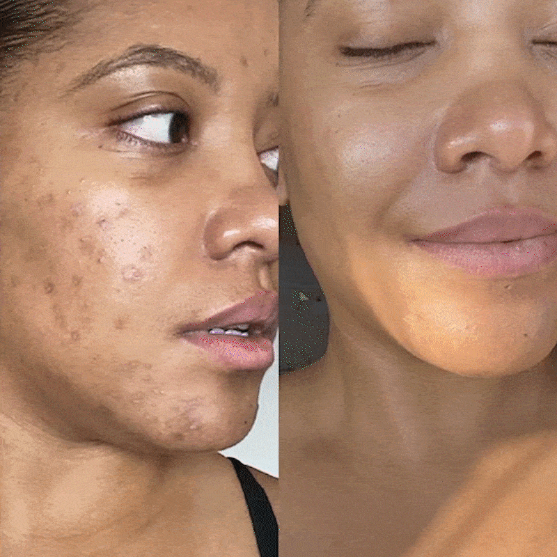 before using gleamin and after gif