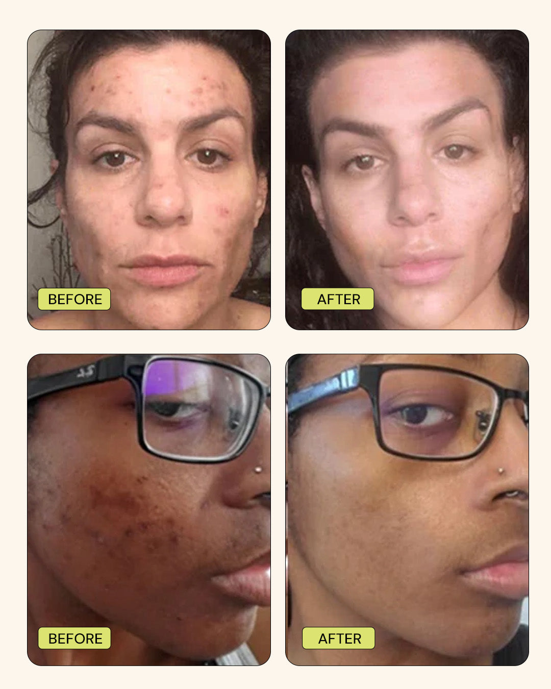 before using gleamin and after gif